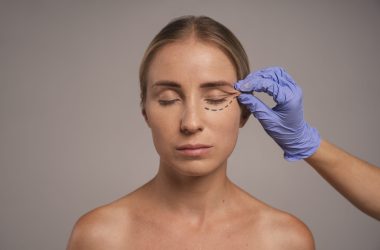 Medicaroute Blepharoplasty