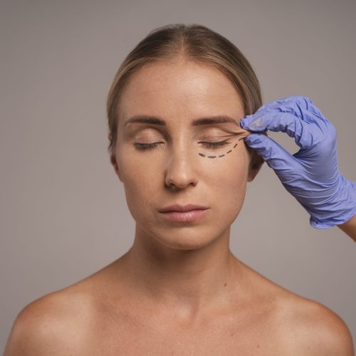 Medicaroute Blepharoplasty