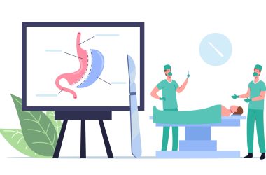 Medicaroute-Gastric-Sleeve-Surgery-scaled