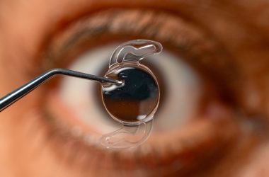Medicaroute-cataract-surgery