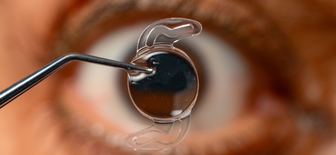 Medicaroute-cataract-surgery