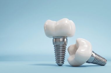 Medicaroute-dental implant