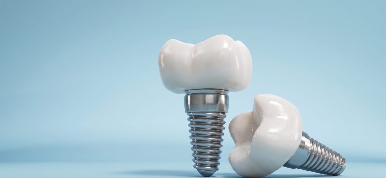 Medicaroute-dental implant