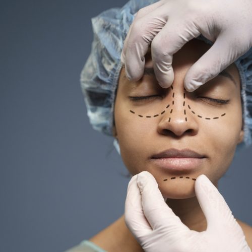 Medicaroute-rhinoplasty