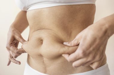 Medicaroute-tummy tuck