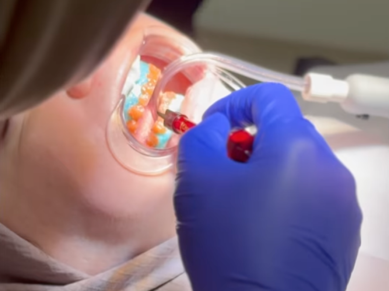 Dentist Bilal Turan is treating a patient at his private clinic Sindent Dental Clinic