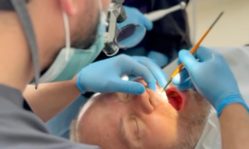 Dentist Bilal Turan is treating a patient at his private clinic Sindent Dental Clinic