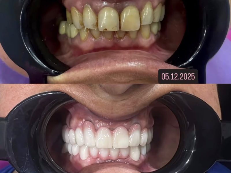 bef6