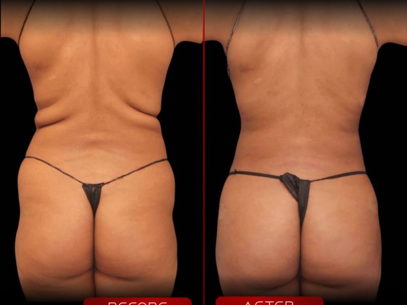 lipobbl_12.09.2025-2