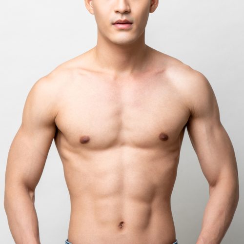 medicaroute-gynecomastia recovery